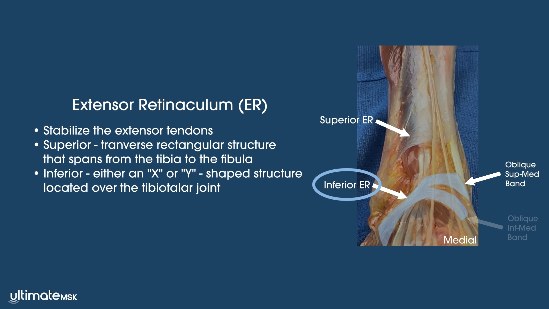 Persistent Ankle Pain after Ankle Injury