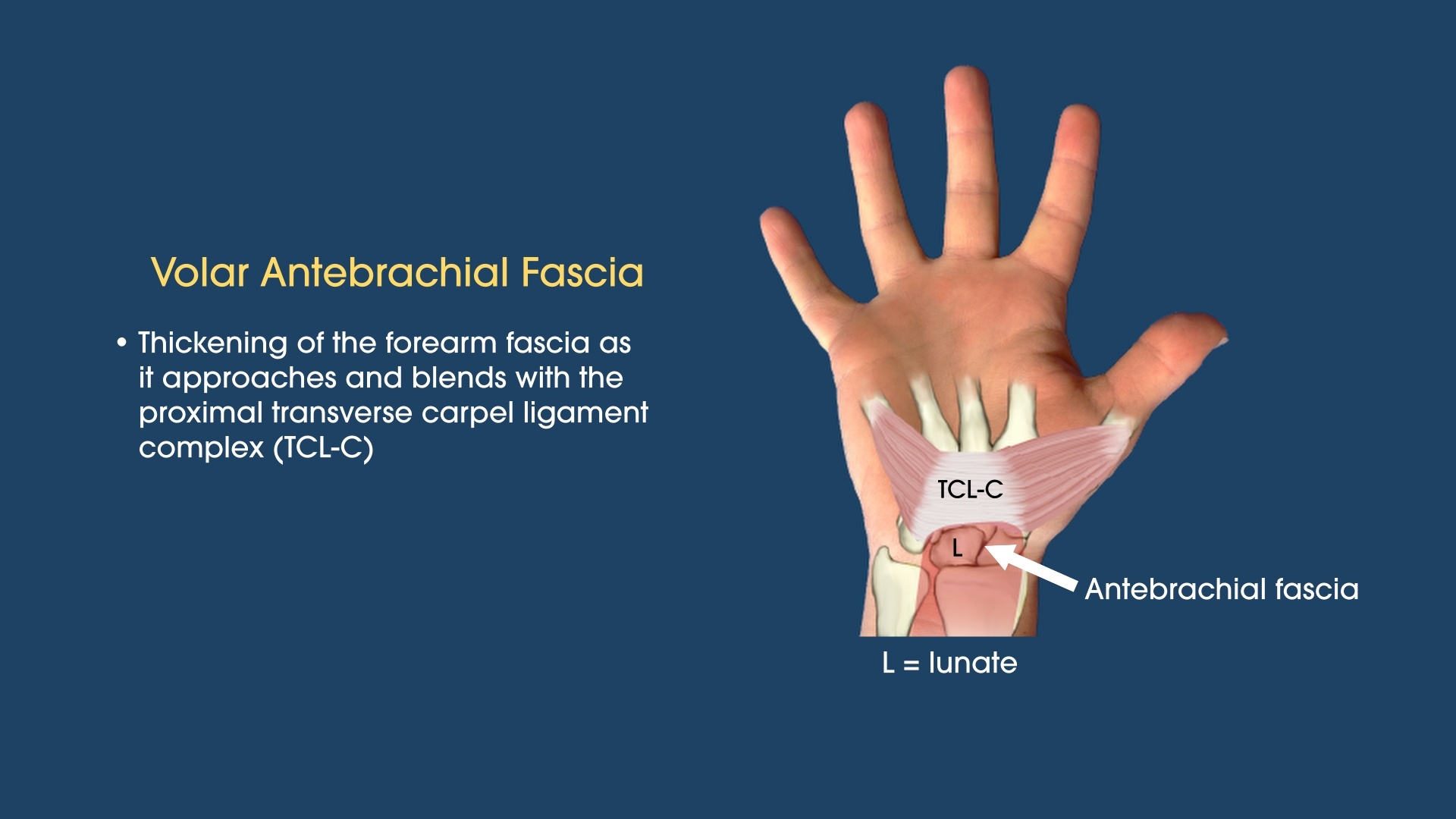 The Antebrachial Fascia in the Carpal Tunnel Evaluation
